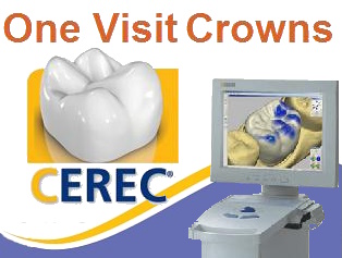 cerec