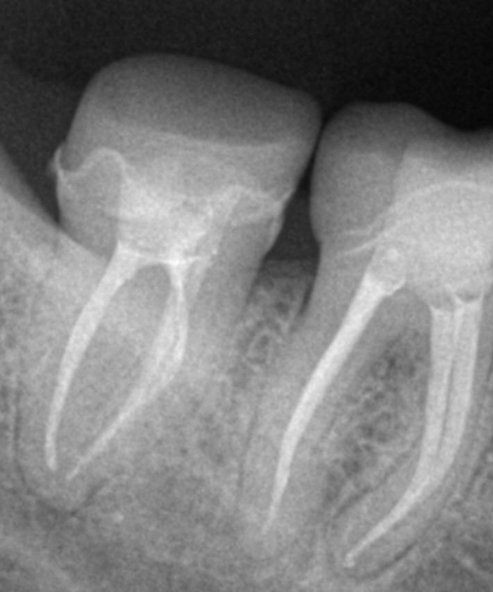 rct x ray